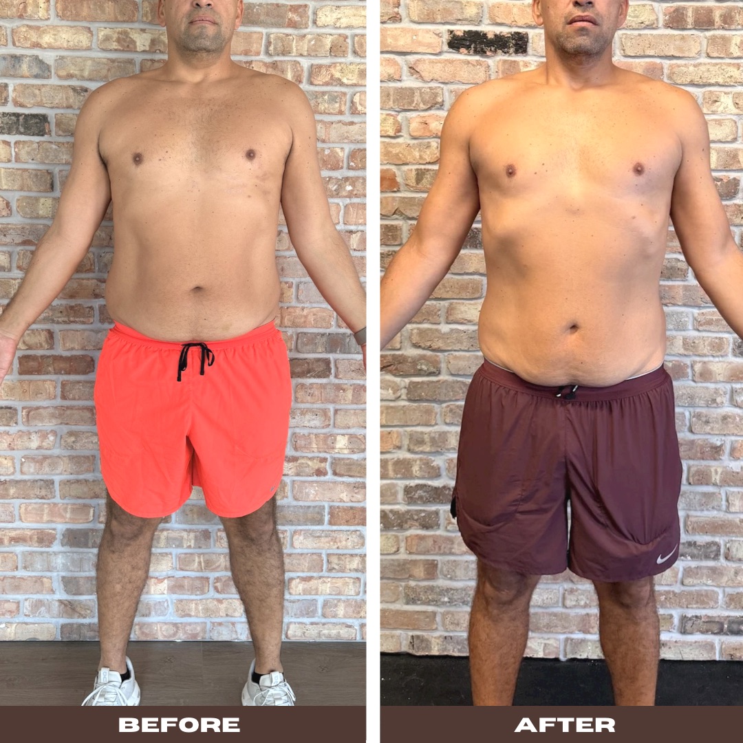 Antes e depois de aluno com redução de gordura abdominal