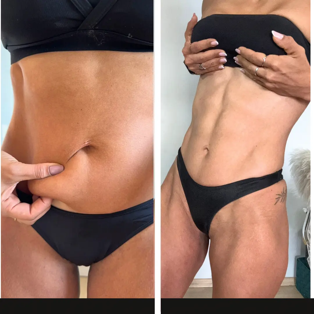 Antes e depois de aluna com definição abdominal