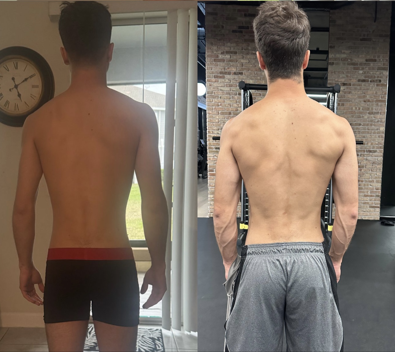 Resultado de definição muscular nas costas